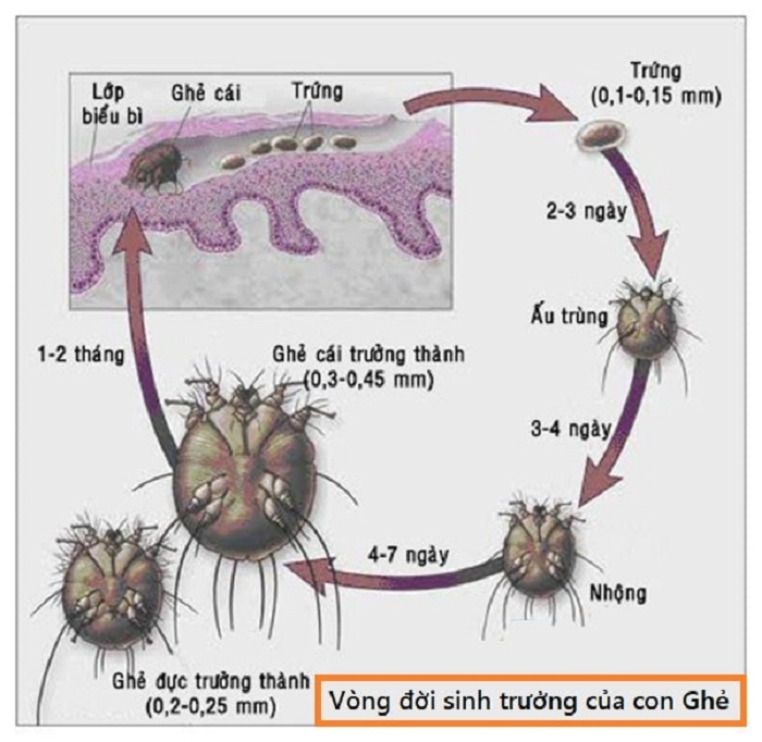 Vong-doi-cua-ky-sinh-trung-ghe